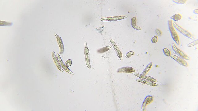Rotifer colony with a passing ciliate under 100x brightfield microscopy. Detailed 4K scientific stock footage of mixed microscopic freshwater organisms.