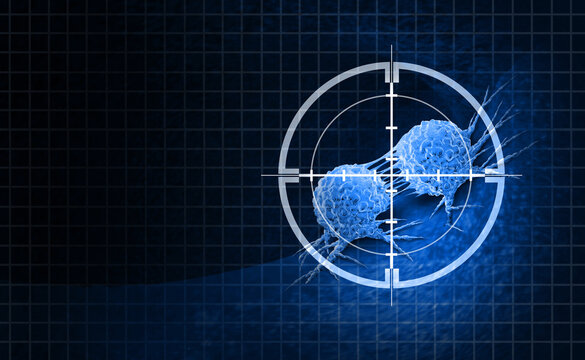 Oncology Cancer Treatment Medical Science fighting Cancer and malignant tumors with surgical removal or radiation treatment to eliminate cancerous cells as a symbol of Immunology with immunotherapy or