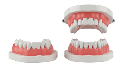 Obraz premium Dental prosthesis model set demonstrating upper and lower jaw structures isolated on transparent background