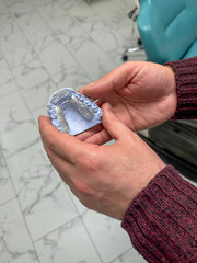 Dental mold of upper teeth in clinical setting. The mold showcases individual tooth anatomy and is used for orthodontic or prosthodontic purposes such as designing braces, retainers or restorations. © Oksana