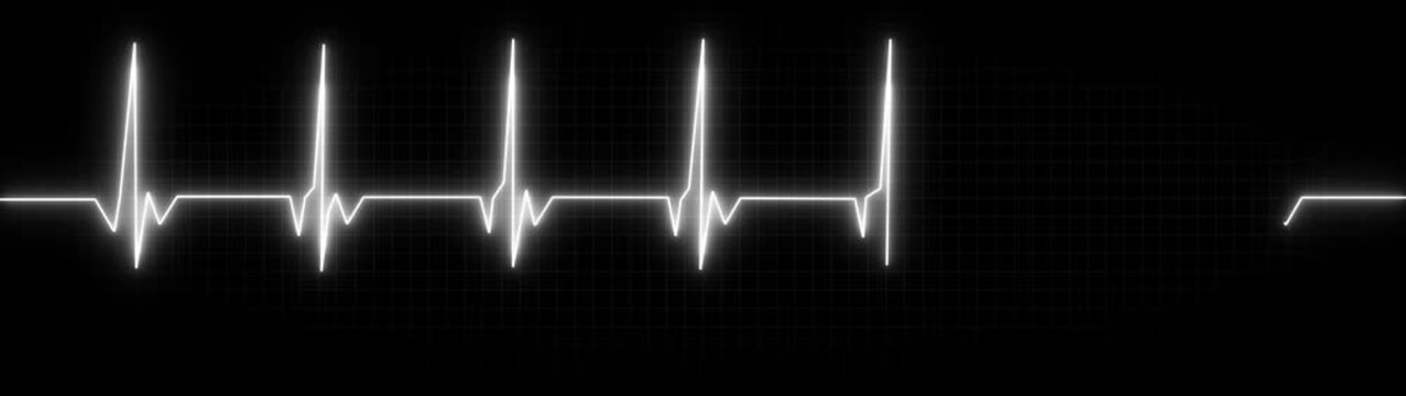 White neon ECG heartbeat pulse line on a dark background.glowing electrocardiogram wave showing medical health monitor, emergency cardiology signal and life rhythm concept.