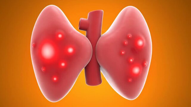 Medical Animation Showing Thyroid Gland with Tumors and Nodules.