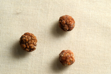 Gallstones removed from a human gallbladder