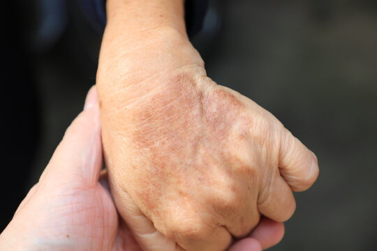 ging hands aging hands aging hands showing wrinkles and age spots, elderly hands, senior skin texture, aging process, healthcare and aging society concept