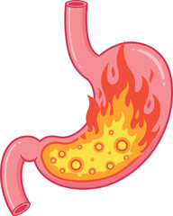 Fototapeta premium Human stomach with internal fire and acid reflux vector illustration isolated on white background, 