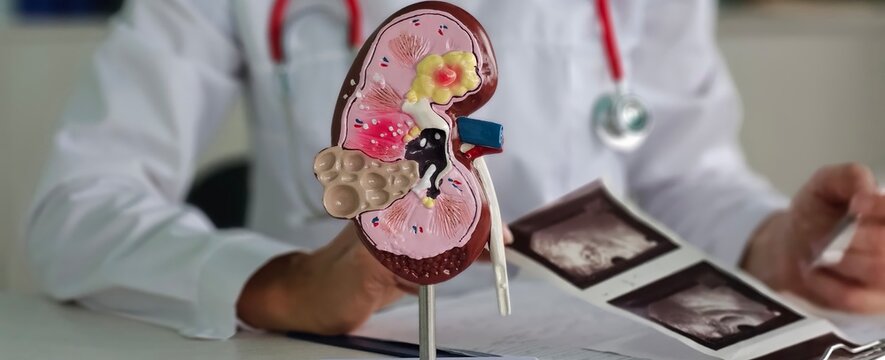 Urology and treatment of kidney diseases