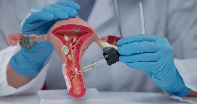 Gynecologist uses pipette with oil to moisten the mucous surface on women reproductive system model in clinical.