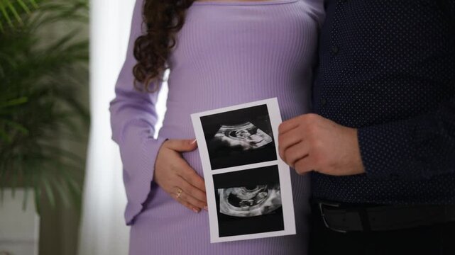 Happy Caucasian couple shares joyful moment at home while holding the news of their pregnancy with ultrasound photo, celebrating upcoming addition to their family together.