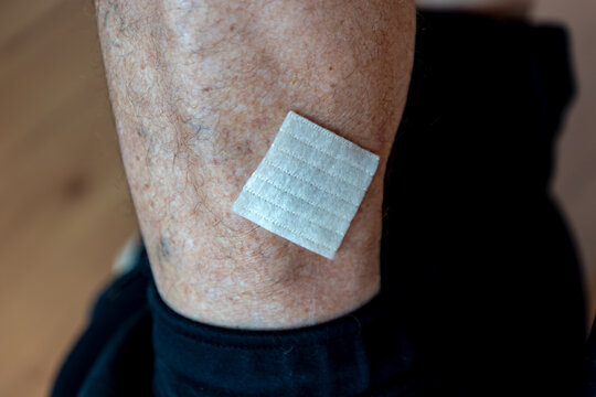 Healthcare and medical concept, Selective focus of white bandage or plaster covered a little bit lesion on skin, A msn with wound or abrasion marks, Blister on back side of the leg calf.