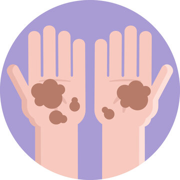 An icon showing unclean hands, indicating a potential source of food contamination due to poor hand hygiene.