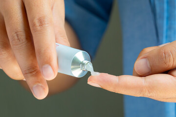 Hand of woman squeezing muscle rub cream from tube onto finger, analgesic ointment for pain relief,...