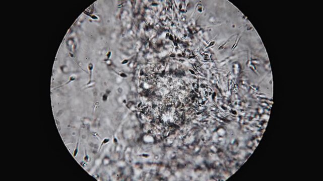 Real footage of human sperm under a light microscope 100x fertilizing an egg cell moving fast 4K HQ 