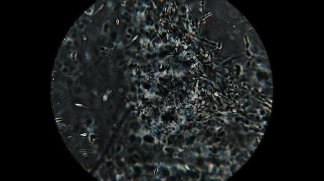 Real footage of human sperm under a light microscope 100x fertilizing an egg cell moving fast 4K HQ