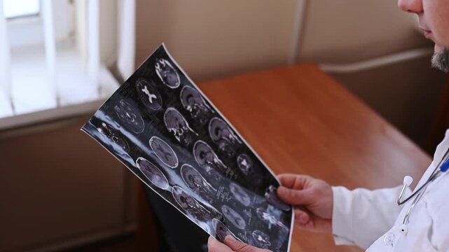 A doctor examines a close-up of a brain MRI in a hospital office. Diagnosis of neurological problems and migraines, stroke, concussion, and head injury.