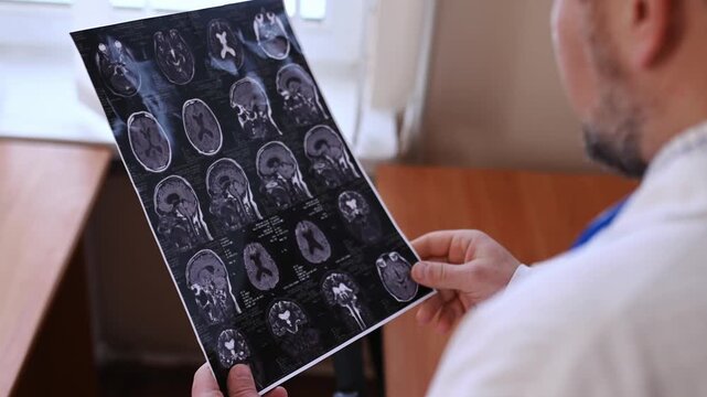 A doctor examines a close-up of a brain MRI in a hospital office. Diagnosis of neurological problems and migraines, stroke, concussion, and head injury.