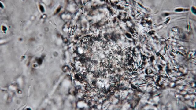 Real footage of human sperm under a light microscope 100x fertilizing an egg cell moving fast 4K HQ