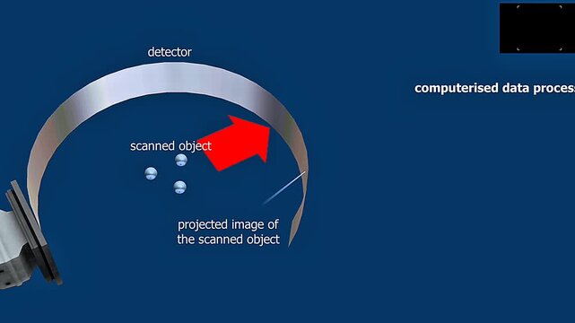 Pricipal of operation of a CT scanner