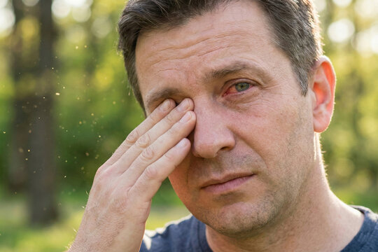 Mature man rubbing irritated itchy eye outdoors in park with visible pollen particles in air. Seasonal allergy and conjunctivitis concept.