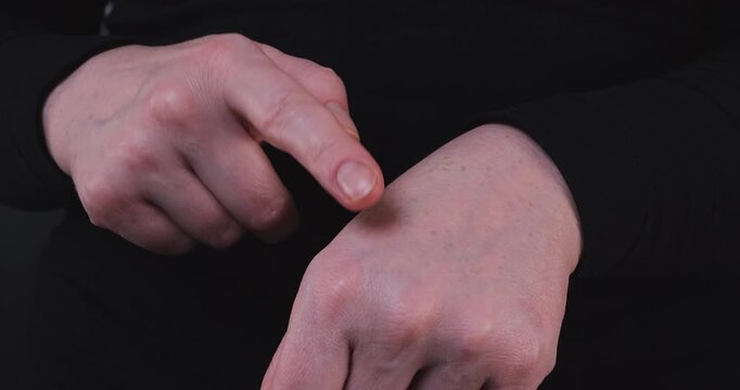 Adult woman highlighting age spots on her hands, representing sun damage, aging, and the need for skincare and anti-aging products.