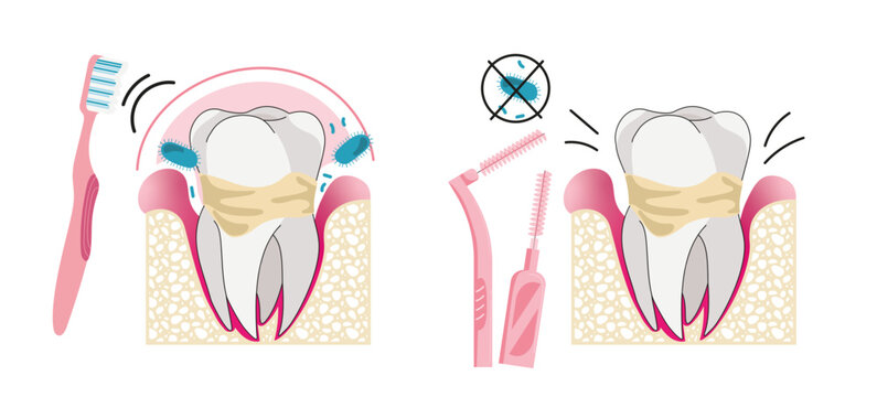 Illustration sur l&rsquo;hygi&egrave;ne bucco-dentaire et les gestes essentiels pour pr&eacute;server la sant&eacute; des dents et des gencives