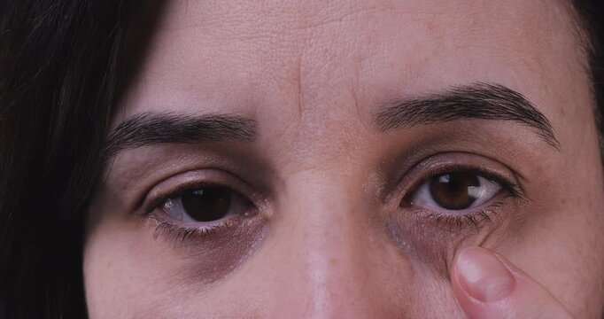 Adult woman highlighting dark circles under her eyes, representing fatigue, aging, anti-wrinkle care, and the need for skincare products