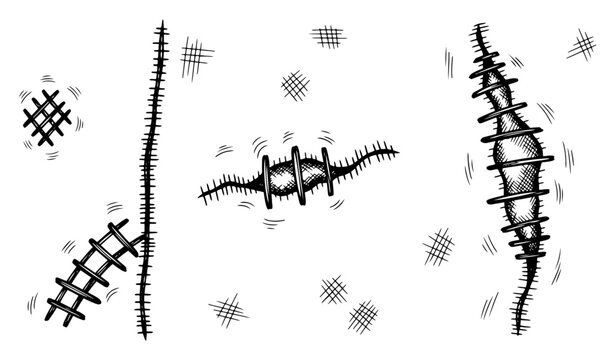 Set of various hand drawn medical stitches and surgical scar sketches