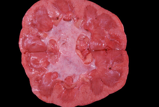 Human kidney