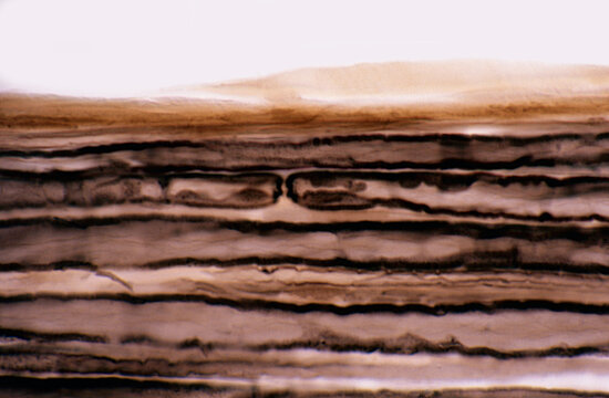 Myelinated nerve fibers. Nodes of Ranvier