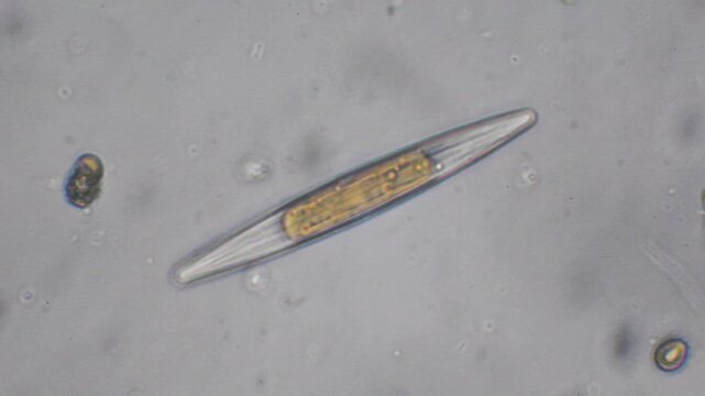 freshwater diatom and other microorganisms,  timelapse, magnification x400, Monza, Lambro Valley regional park, Monza, microscopic photo, algae,  freshwater diatoms, diatom,