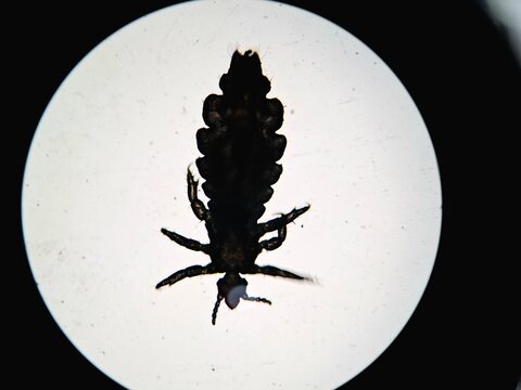Microscopic silhouette of a head louse (Pediculus humanus capitis) under brightfield illumination. Detailed view of the insect's anatomy, including legs and segmented body. High magnification for para