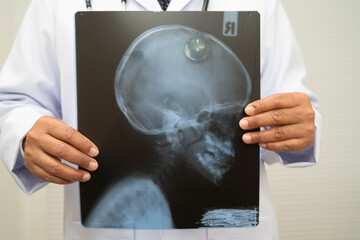 Doctor examining brain radiography xray film.