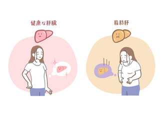健康な肝臓と脂肪肝の女性のイラストセット