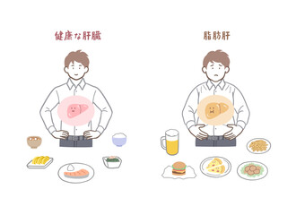 健康な肝臓と脂肪肝の男性のイラストセット