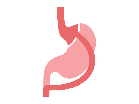 Roux en Y Gastric Bypass Surgery Illustration
