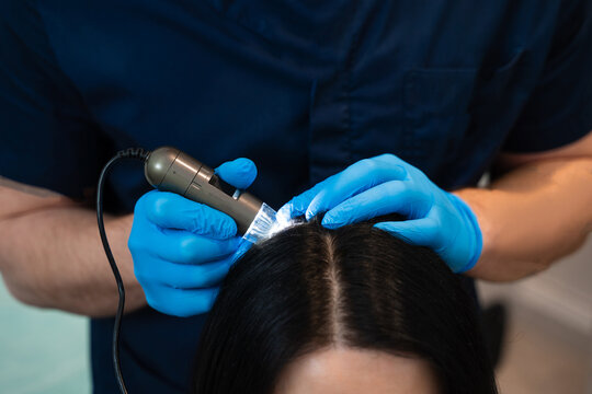 Digital trichoscope trichology check for scalp condition and hair health.