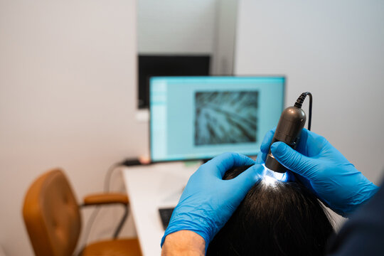 Scalp analysis with digital trichoscope in professional trichology examination.