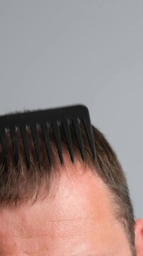 Close-up of male head with thinning hair and baldness while combing, showing receding hairline and hair loss problem. Vertical video.