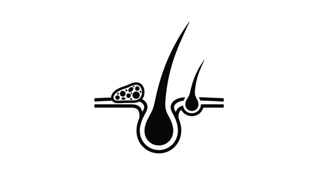 Illustration of a human hair follicle and root structure in black