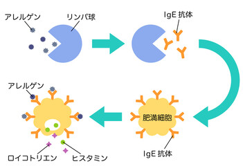 アレルギー発症のしくみ　花粉症のメカニズム
