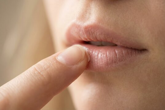 Macro close-up of a person's finger touching a cold sore or chapped lips.