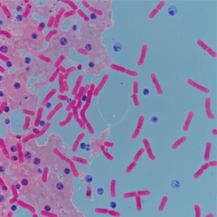 Vector of ARB (Acid Fast Bacillus) image in sputum smear. Microscopic view of acid-fast bacilli in sputum smear. Ziehl-Neelsen stained Mycobacterium tuberculosis bacteria under microscope.  © Bediha Duru Öksüz