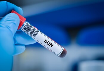 Obraz premium Blood sample tube for BUN test analysis.