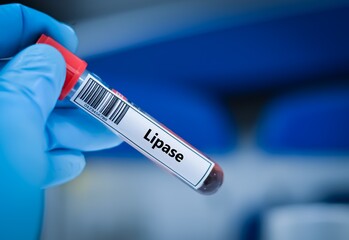 Obraz premium Blood sample tube for lipase test analysis.