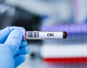 Naklejka premium Blood sample tube for complete blood count test analysis.