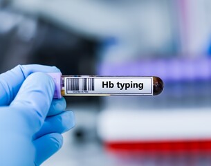 Obraz premium Blood sample tube for Hb typing test analysis.