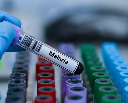 Blood sample tube for malaria test analysis.