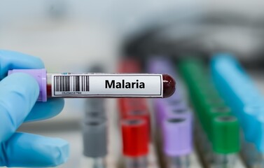 Obraz premium Blood sample tube for malaria test analysis.