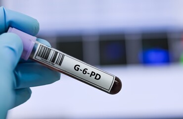 Fototapeta premium Blood sample tube for G-6-PD test analysis.
