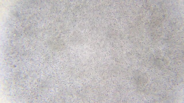 Large bacterial colony with ciliates swimming and feeding on bacteria under 400x brightfield microscopy. Detailed 4K scientific stock footage of microbial predation.