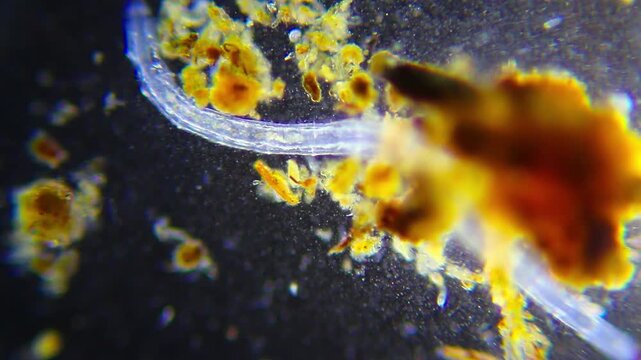 Large annelid worm surrounded by ciliates and a bacterial colony under 40x darkfield microscopy. Detailed 4K scientific stock footage of mixed microfauna interaction.